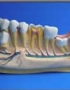 Anatomy model - teeth 